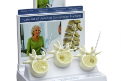GPI can create a customized display option for your custom model and patient education materials.