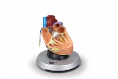 Our custom designed heart model and base were featured in a display at the Smithsonian Institution on aortic valve replacement.