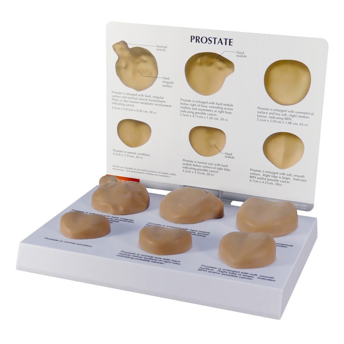 Prostate - Model #3000 - GPI Anatomicals