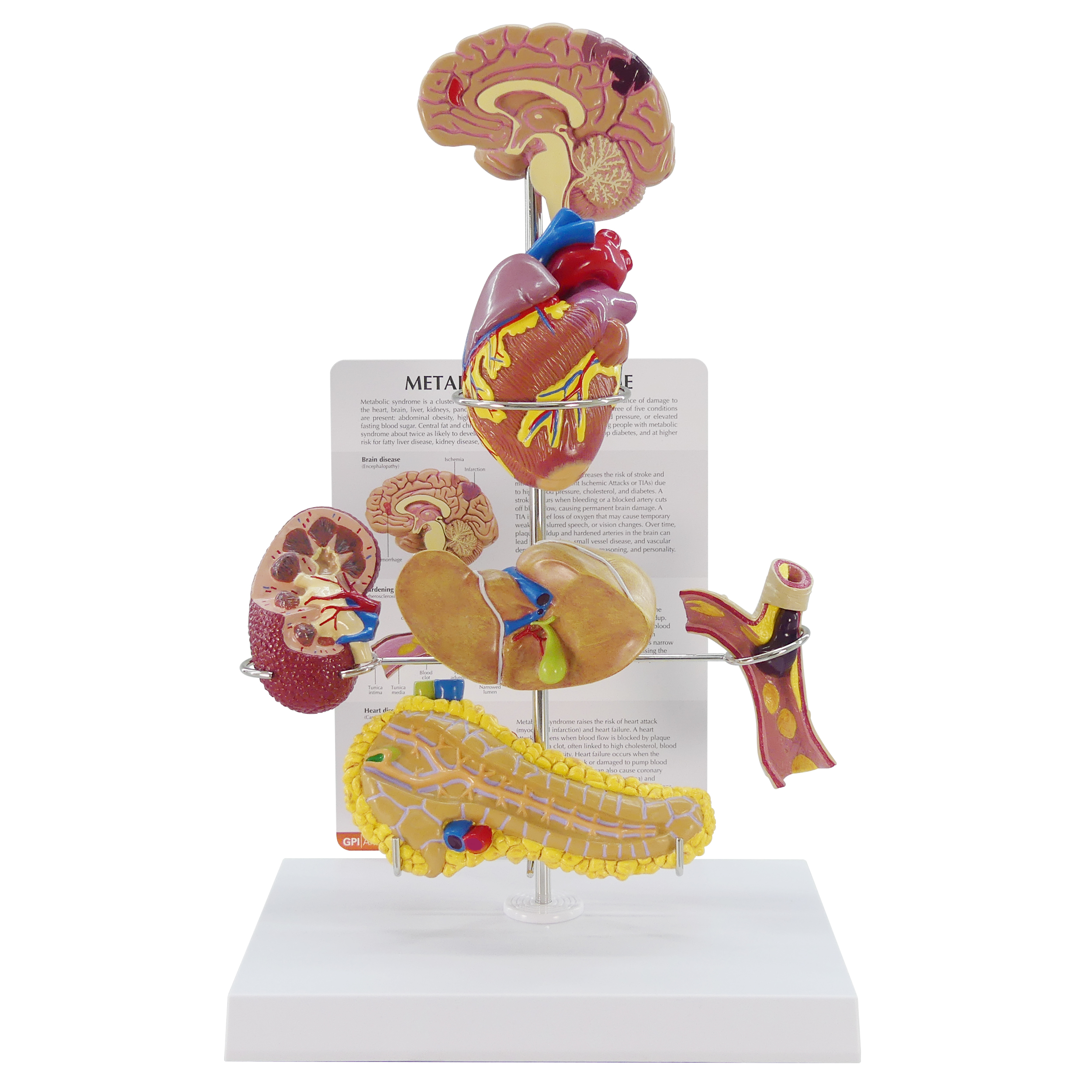 4020_Metabolic_Syndrome_03092026