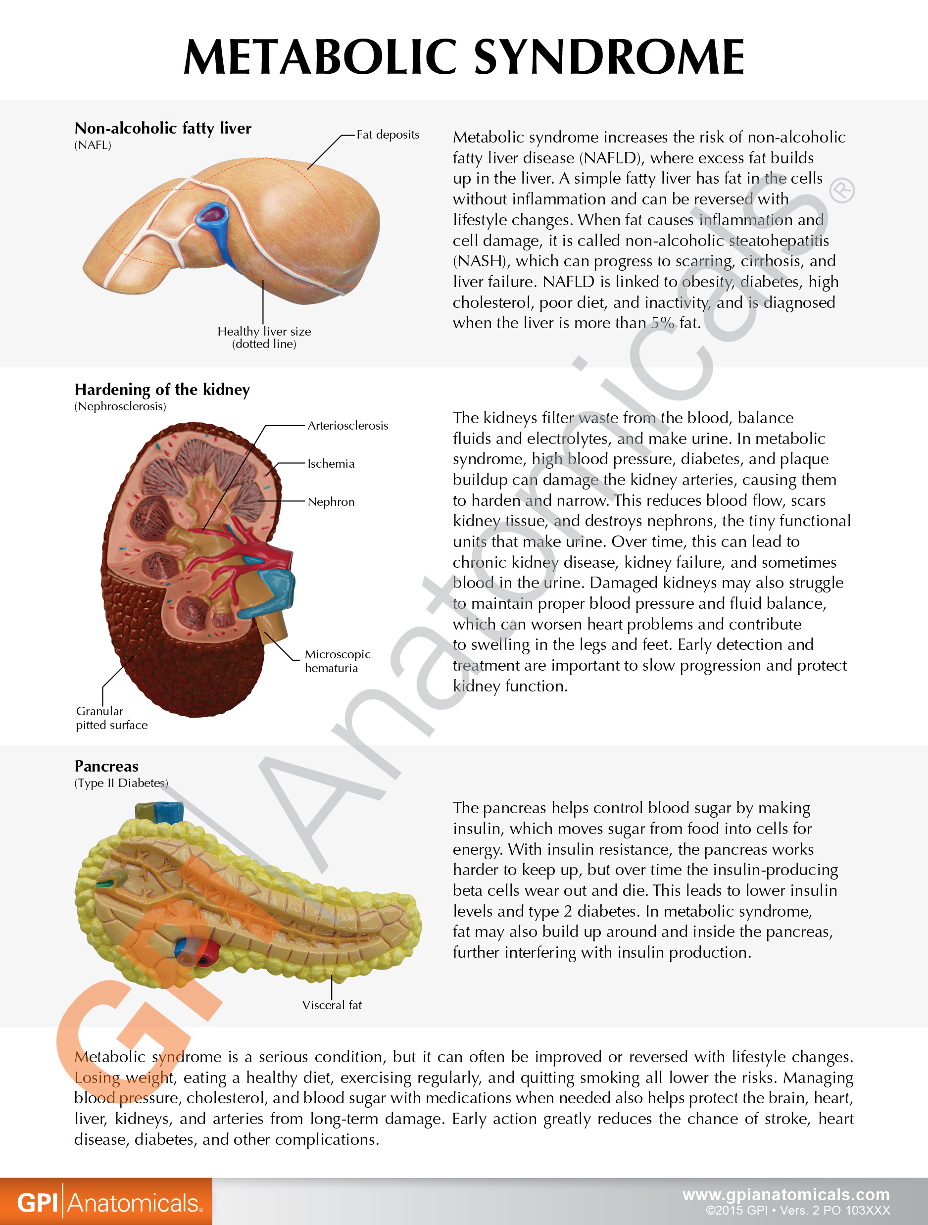 4020_Metabolic_Syndrome_Back_WM