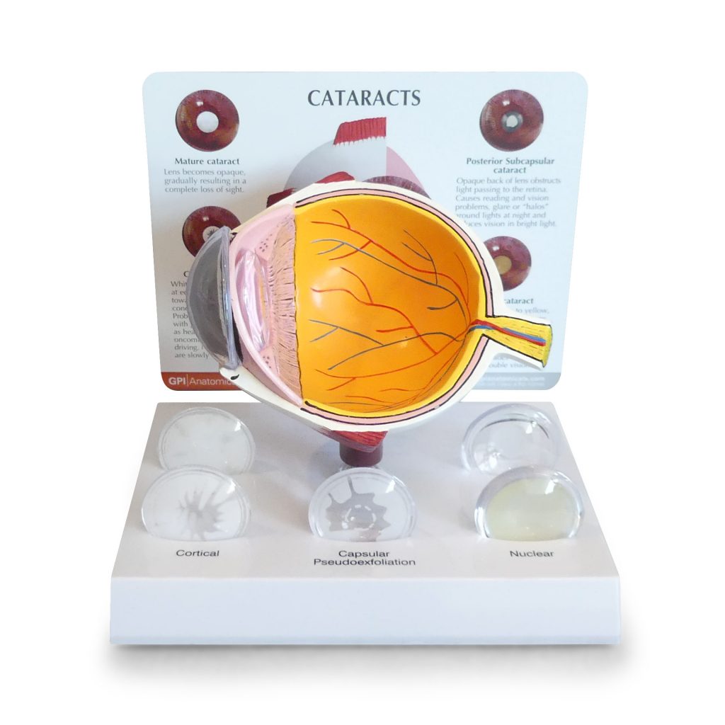 Cataract Eye Model 2800 GPI Anatomicals