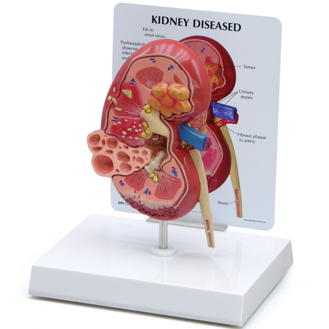 Kidney Normal - Model #3250 - GPI Anatomicals